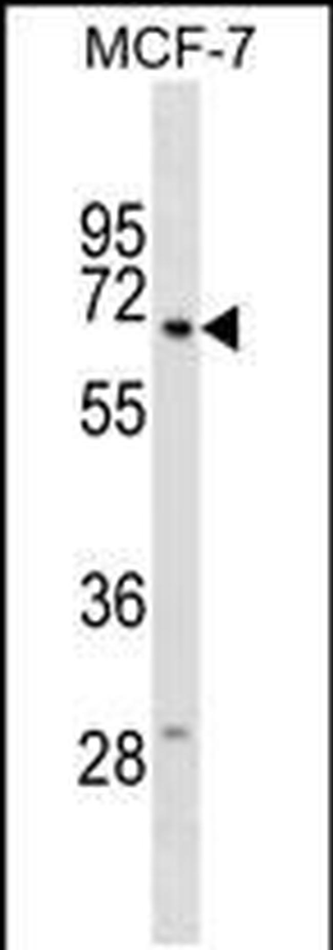 GGT6 Antibody in Western Blot (WB)