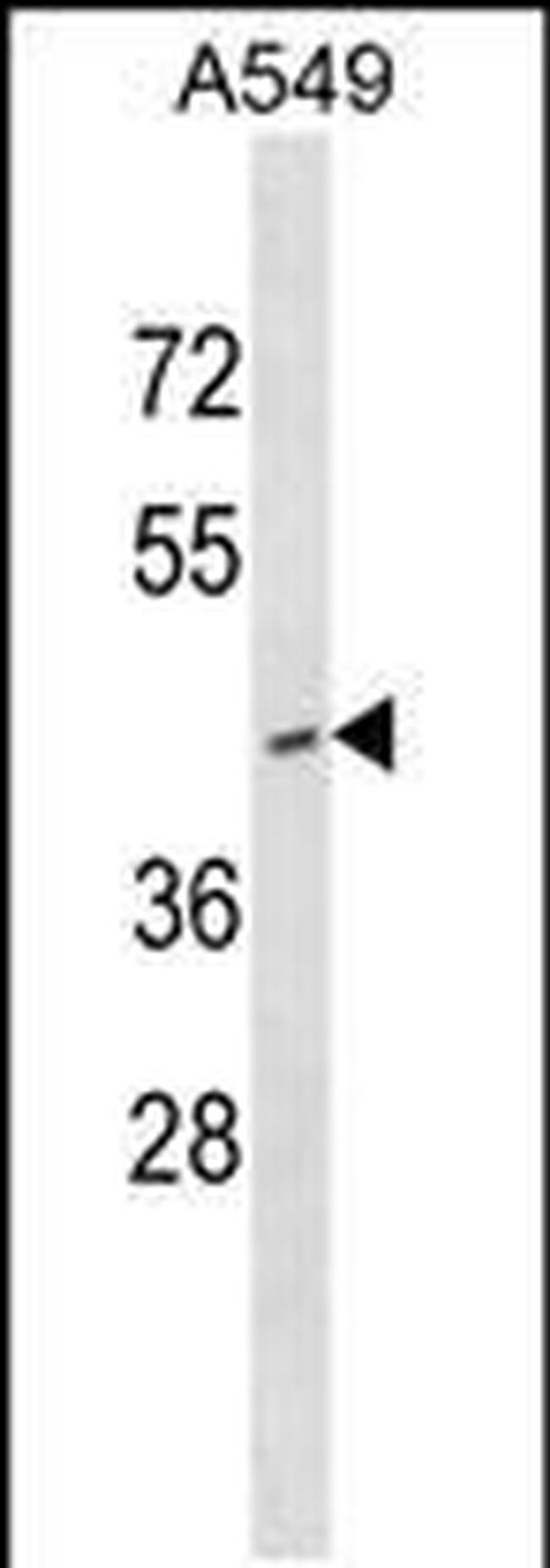 RNF165 Antibody in Western Blot (WB)