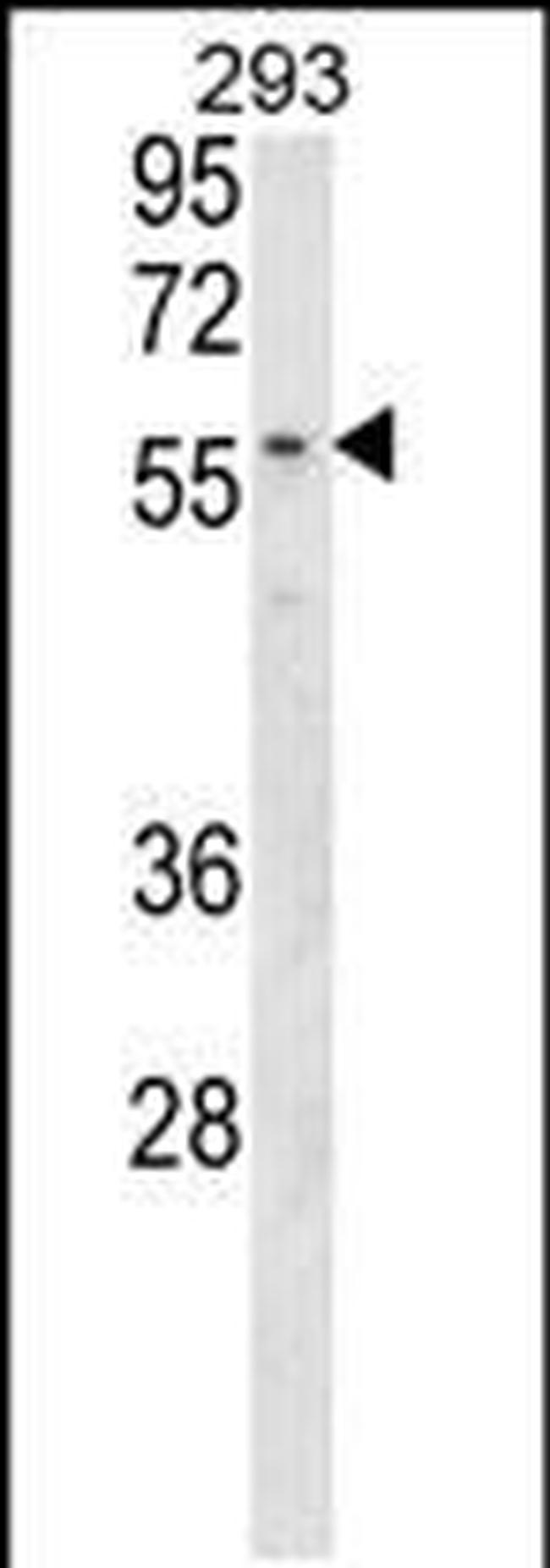 MBOAT2 Antibody in Western Blot (WB)