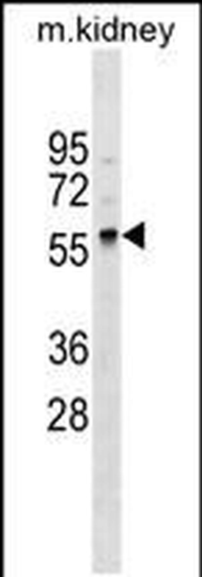 GALNT11 Antibody in Western Blot (WB)