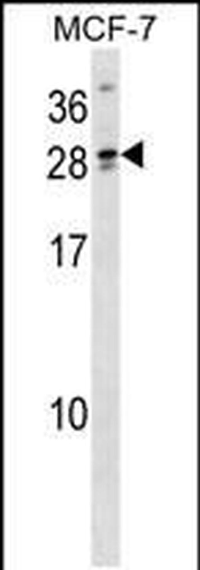 LIPT2 Antibody in Western Blot (WB)