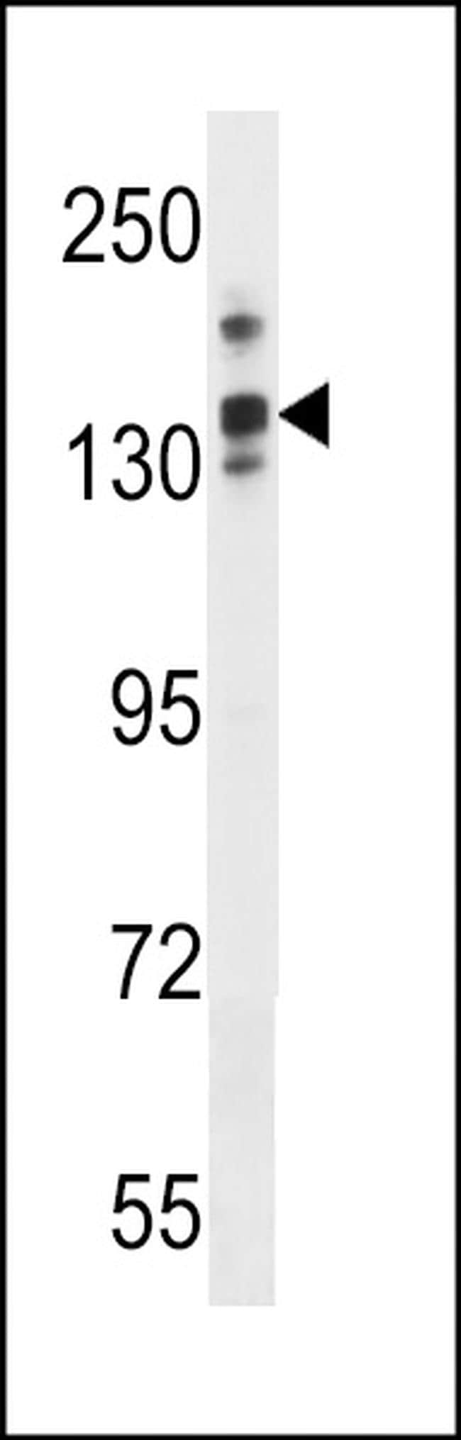 LRRC16A Antibody in Western Blot (WB)