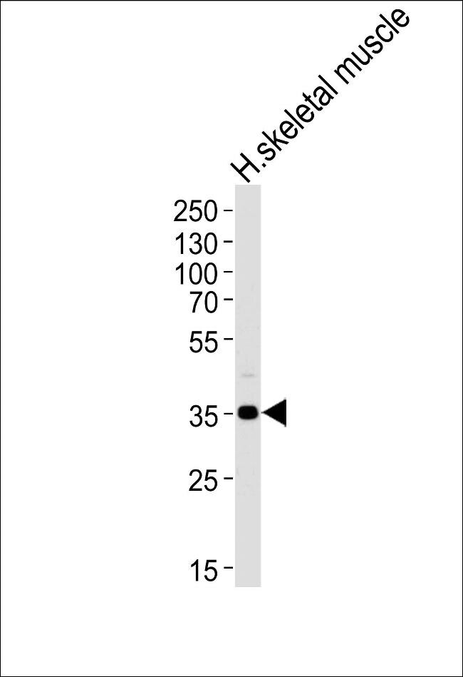 PPP1R3B Antibody in Western Blot (WB)