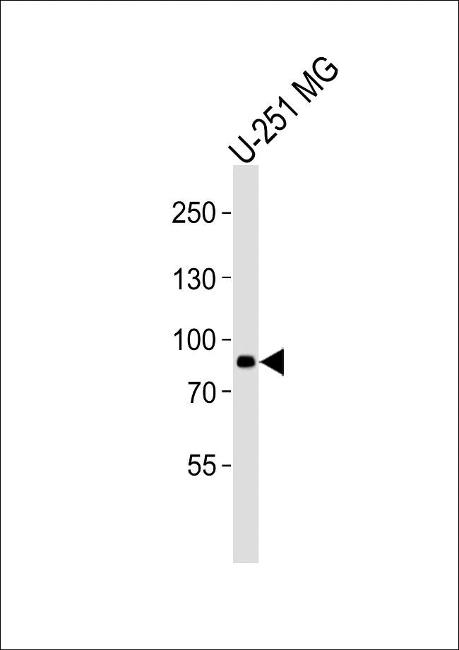 RFX4 Antibody in Western Blot (WB)