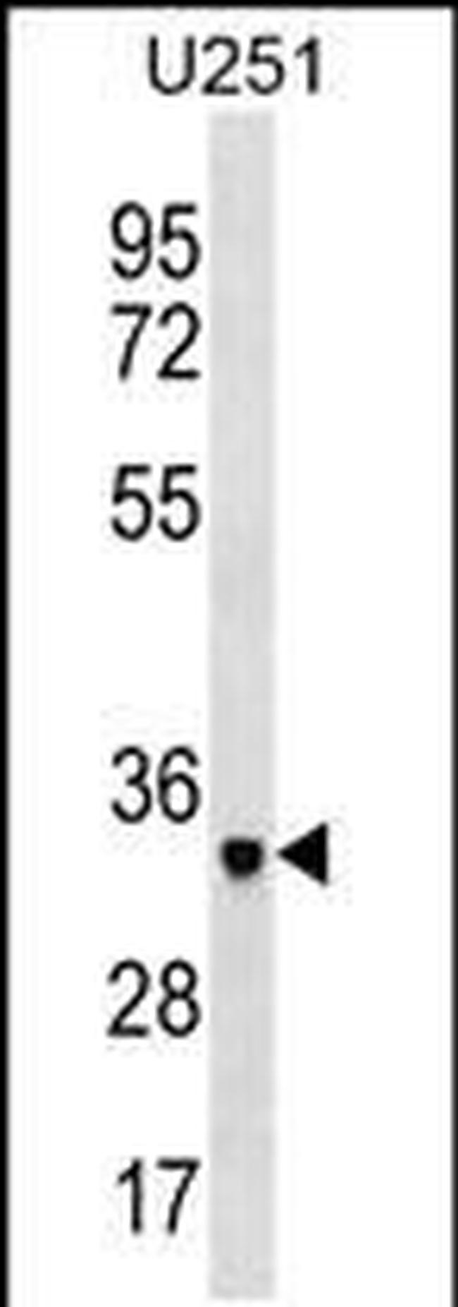 NPL Antibody in Western Blot (WB)