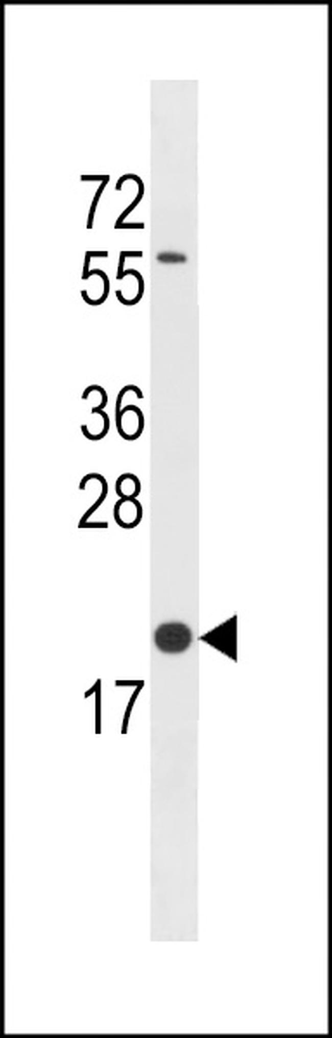 BLOC1S3 Antibody in Western Blot (WB)