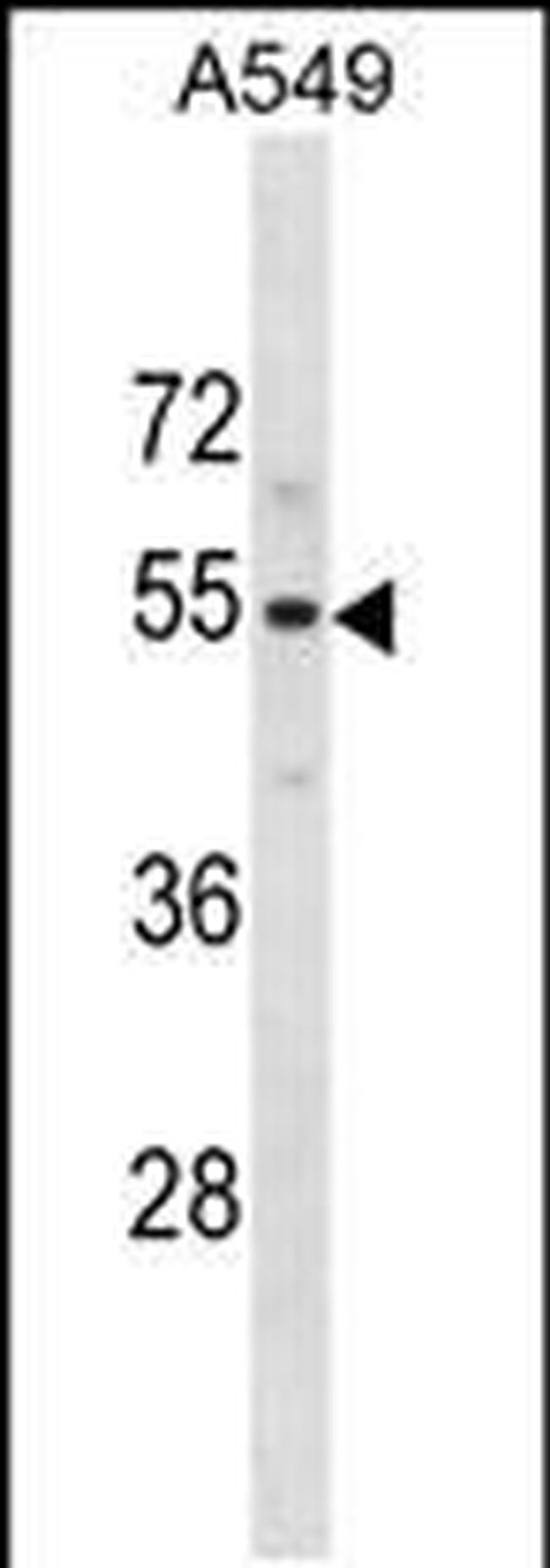 PUS10 Antibody in Western Blot (WB)