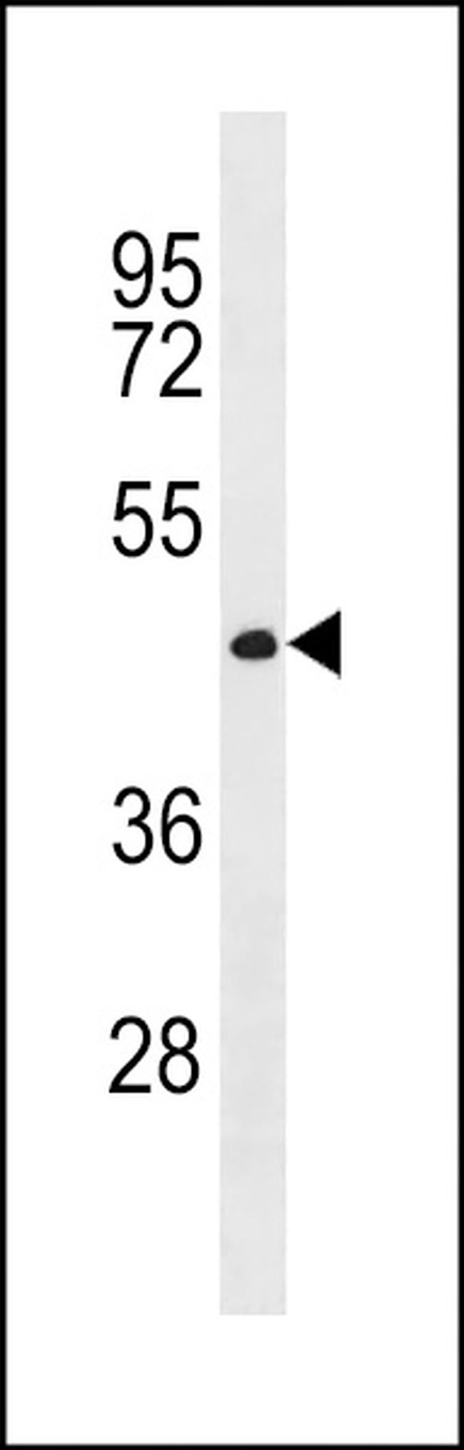 CWC27 Antibody in Western Blot (WB)