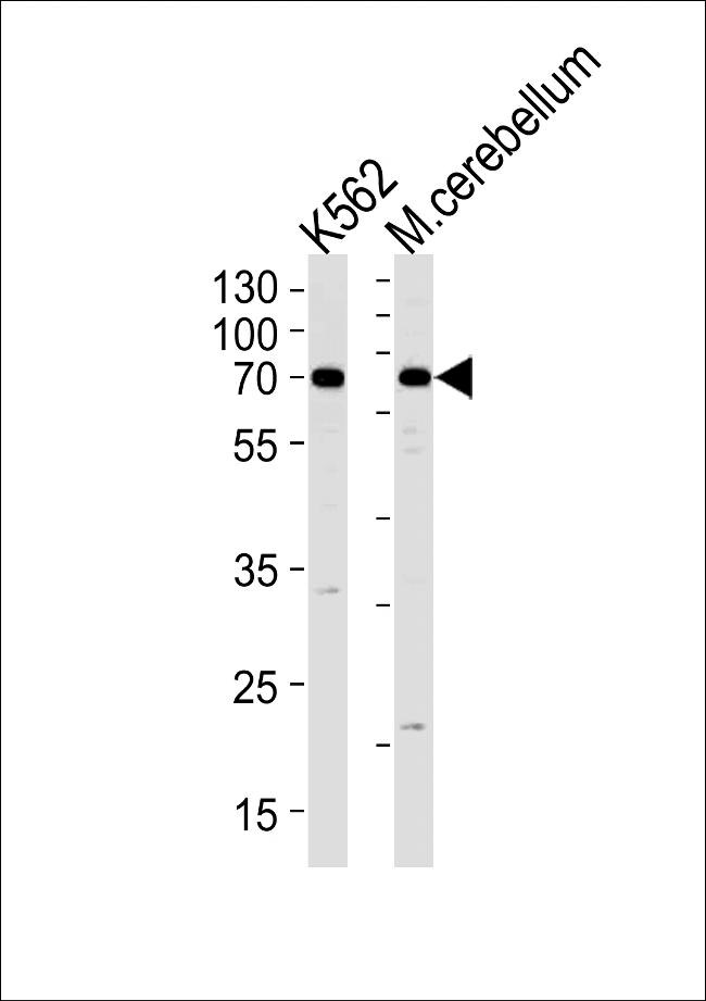 EPM2AIP1 Antibody in Western Blot (WB)