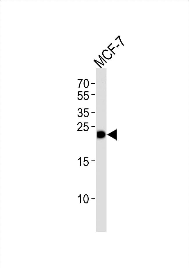 GSTM4 Antibody in Western Blot (WB)