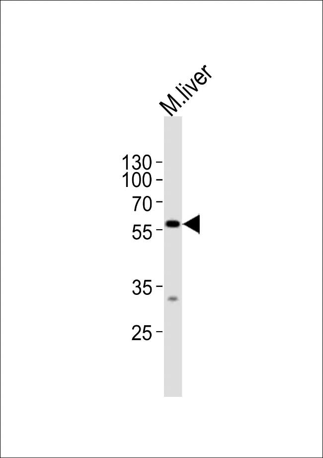 DPYS Antibody in Western Blot (WB)