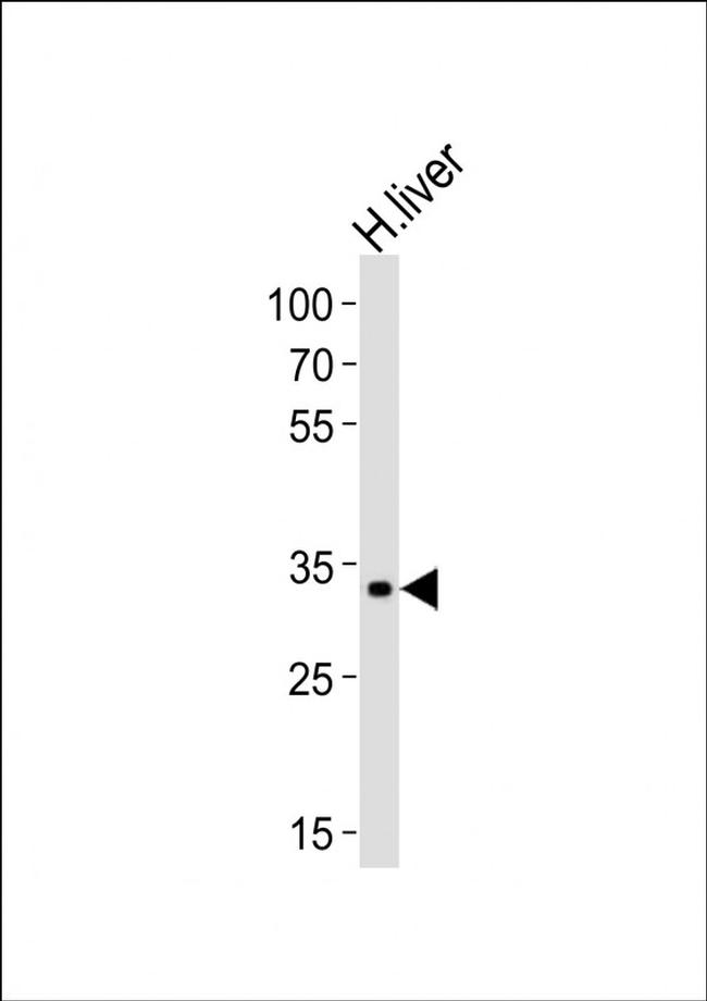 LRTOMT Antibody in Western Blot (WB)