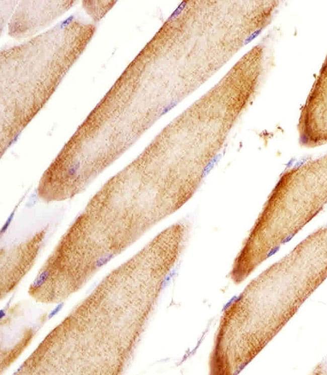 HTR2A Antibody in Immunohistochemistry (PFA fixed) (IHC (PFA))