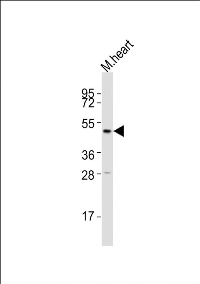 HTR2A Antibody in Western Blot (WB)