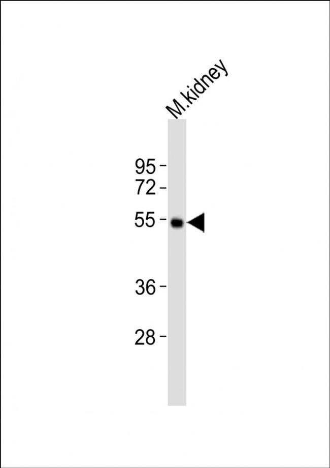 DRD5 Antibody in Western Blot (WB)