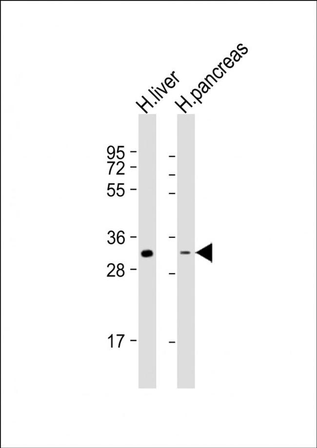 HSD17B8 Antibody in Western Blot (WB)