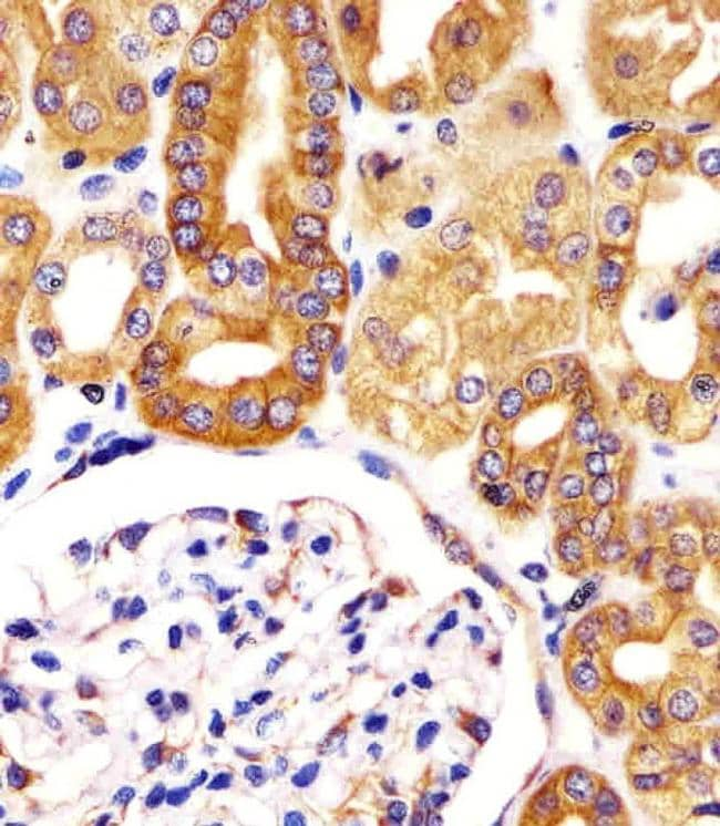 VAC14 Antibody in Immunohistochemistry (PFA fixed) (IHC (PFA))