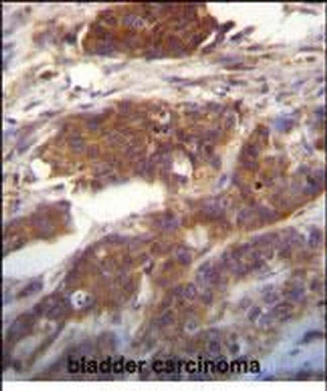 UFC1 Antibody in Immunohistochemistry (Paraffin) (IHC (P))