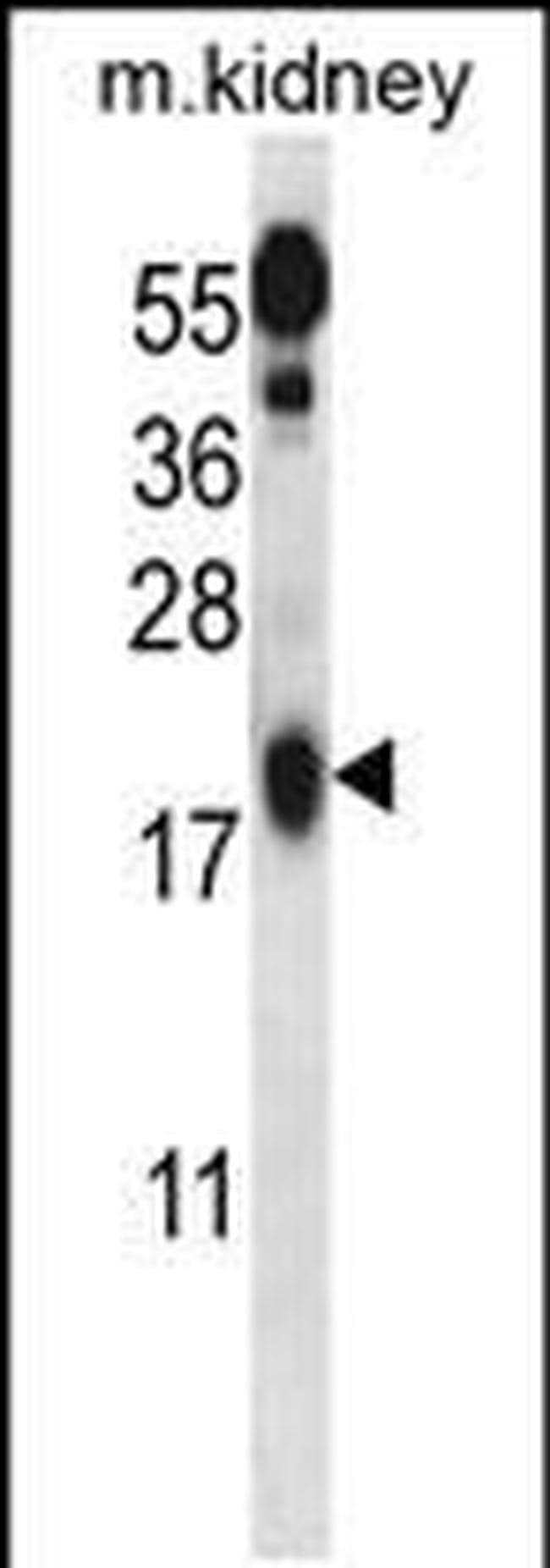 UFC1 Antibody in Western Blot (WB)