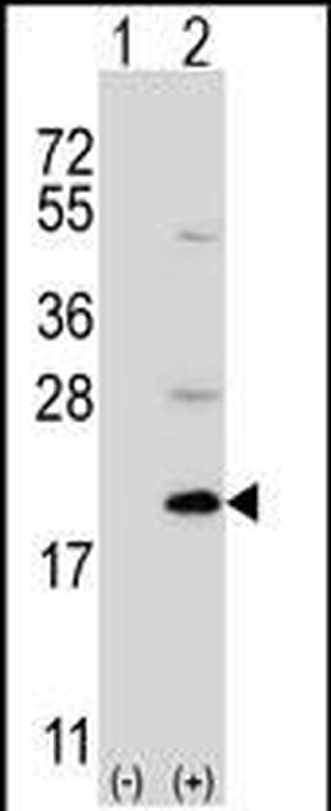 UFC1 Antibody in Western Blot (WB)