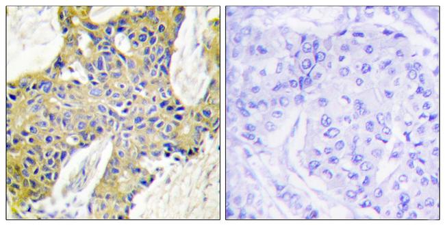 IARS2 Antibody in Immunohistochemistry (Paraffin) (IHC (P))