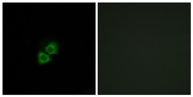 APOA1BP Antibody in Immunocytochemistry (ICC/IF)