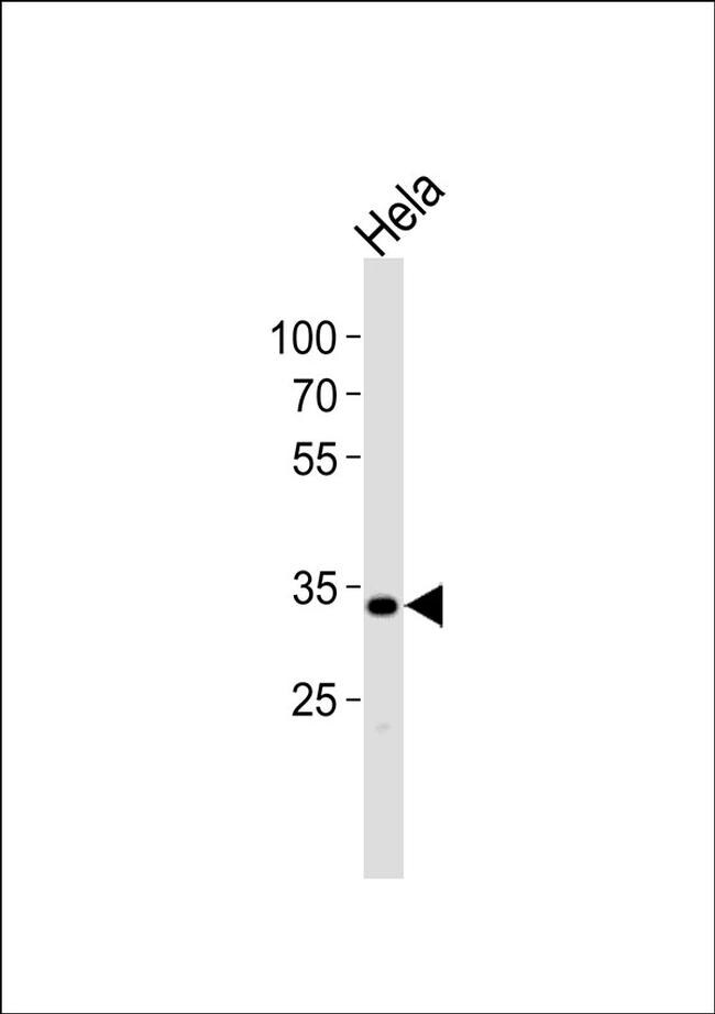 APOA1BP Antibody in Western Blot (WB)