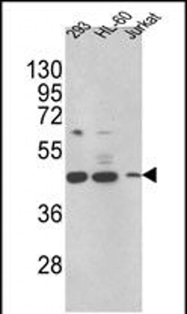 HSD17B7 Antibody in Western Blot (WB)