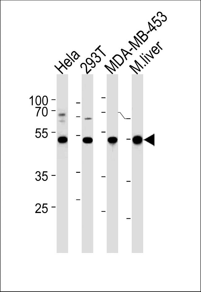 GSS Antibody in Western Blot (WB)