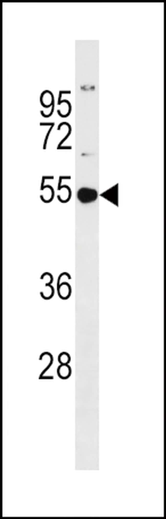 GSS Antibody in Western Blot (WB)