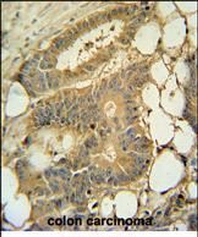 EPS8L3 Antibody in Immunohistochemistry (Paraffin) (IHC (P))