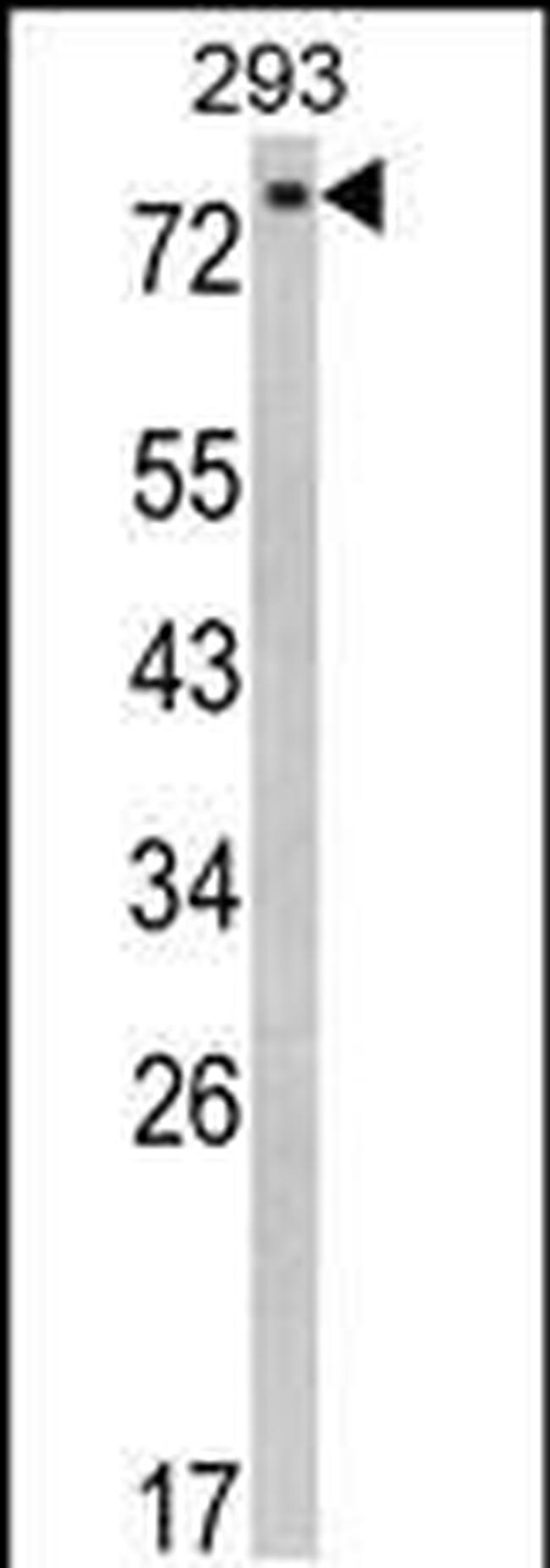 EPS8L3 Antibody in Western Blot (WB)