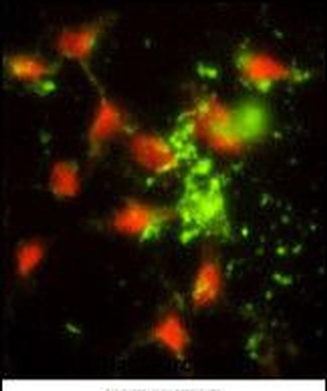 SRP72 Antibody in Immunocytochemistry (ICC/IF)