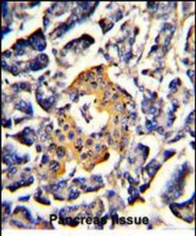 SRP72 Antibody in Immunohistochemistry (Paraffin) (IHC (P))