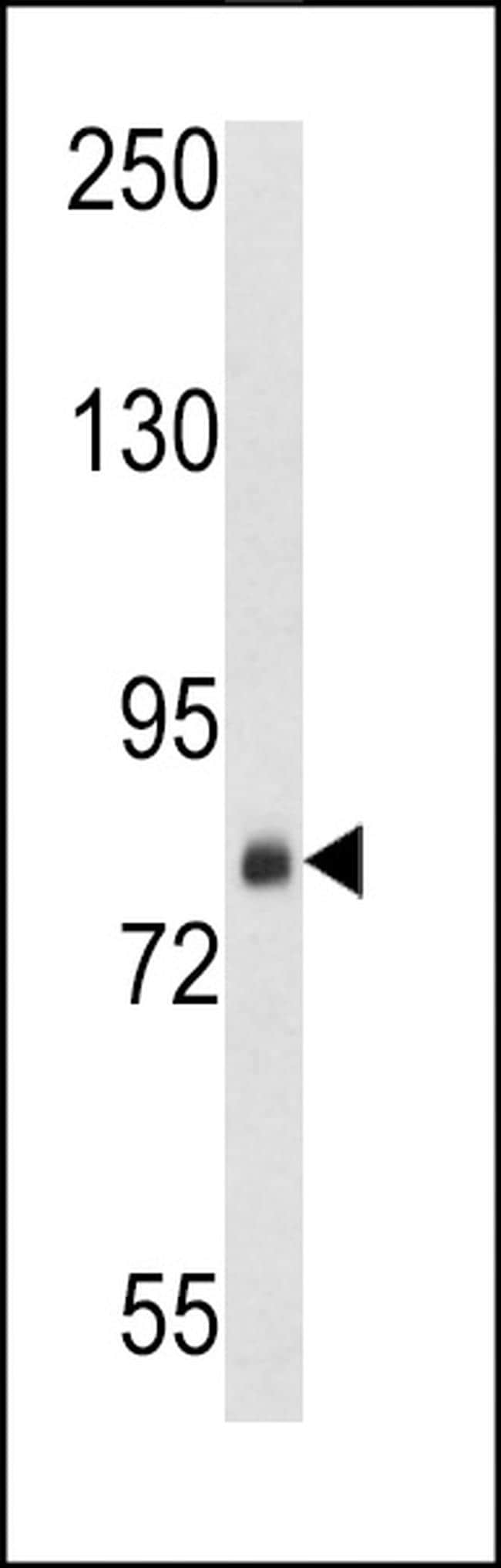 SRP72 Antibody in Western Blot (WB)