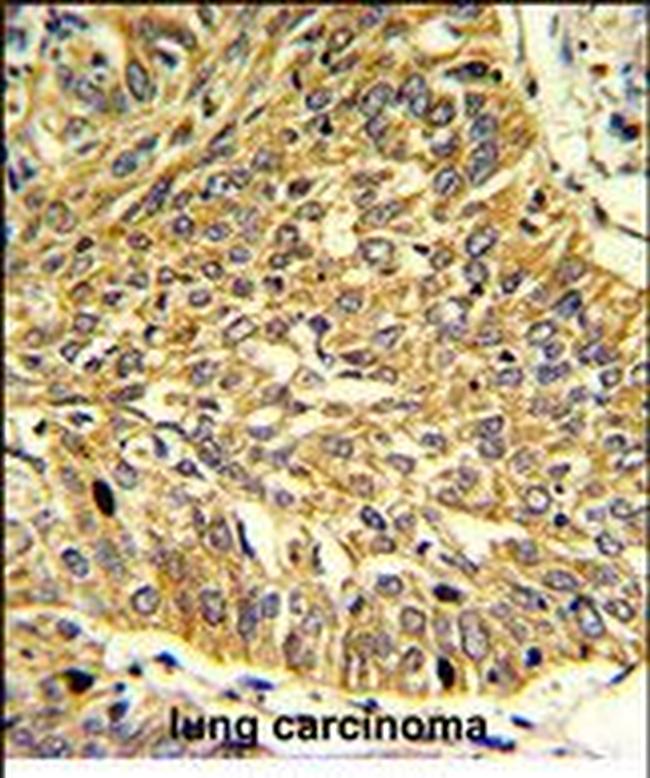 RGP1 Antibody in Immunohistochemistry (Paraffin) (IHC (P))