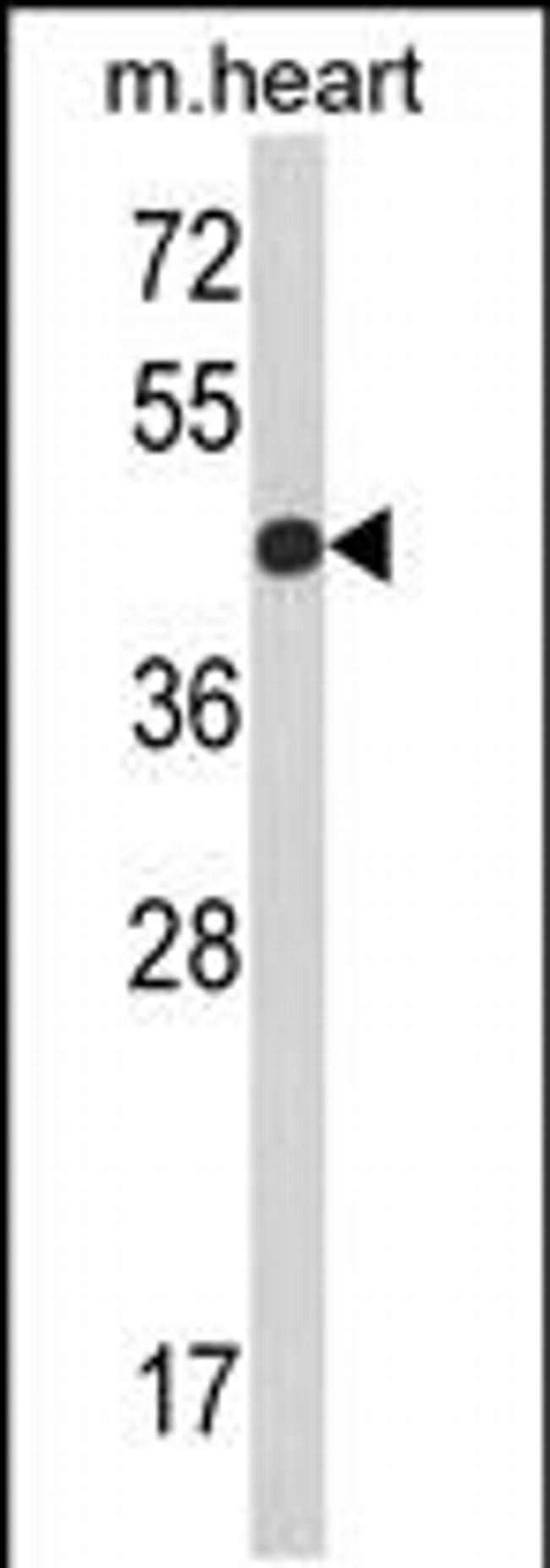 RGP1 Antibody in Western Blot (WB)