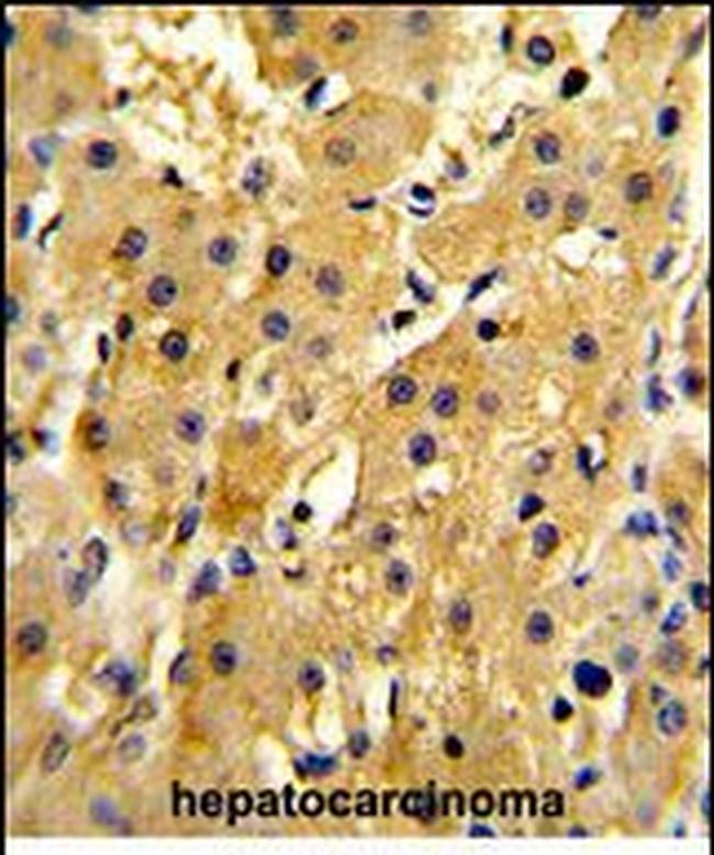 HPD Antibody in Immunohistochemistry (Paraffin) (IHC (P))