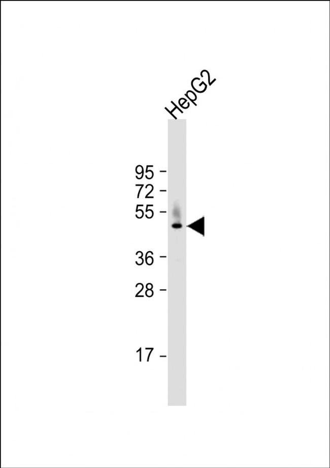 HPD Antibody in Western Blot (WB)