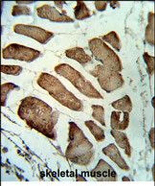 LMOD1 Antibody in Immunohistochemistry (Paraffin) (IHC (P))