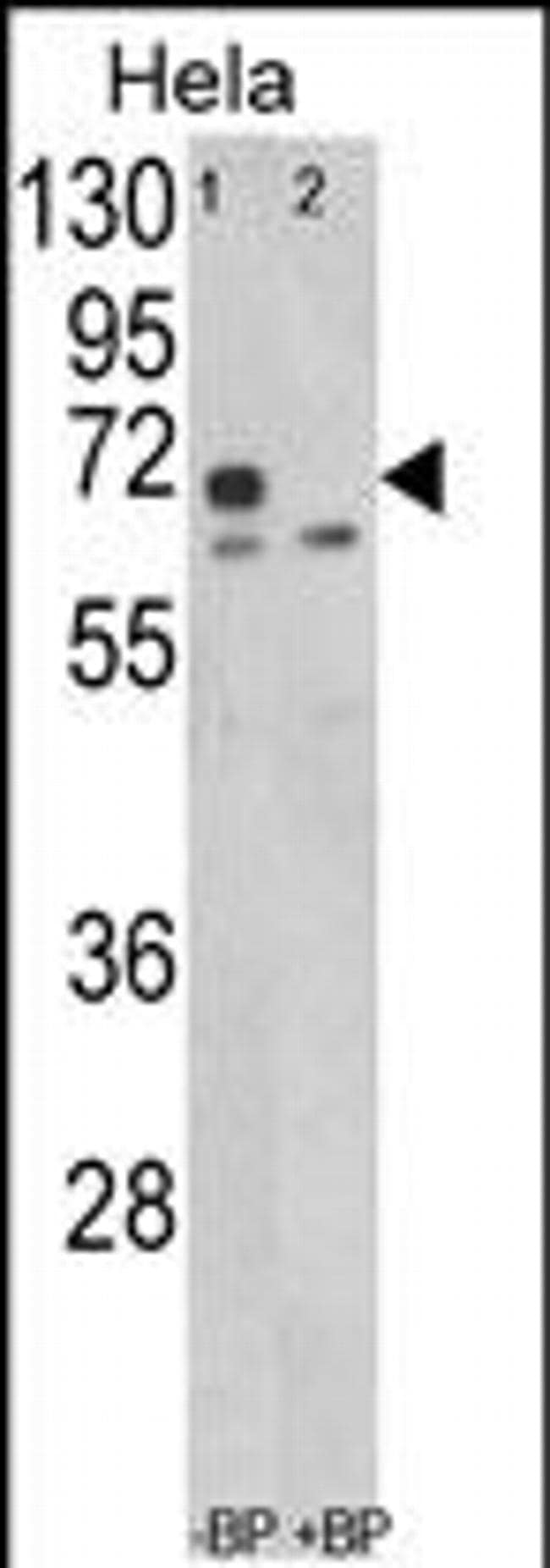 LMOD1 Antibody in Western Blot (WB)