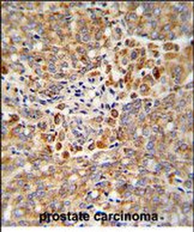 ALKBH3 Antibody in Immunohistochemistry (Paraffin) (IHC (P))