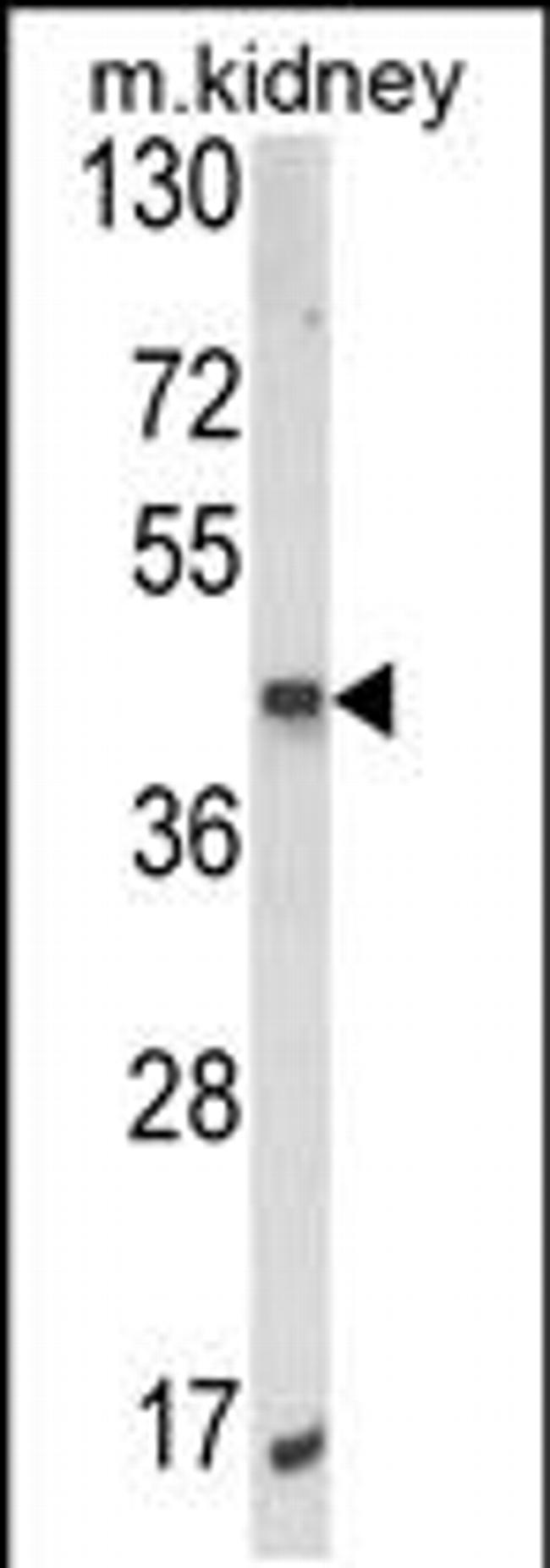 ALKBH3 Antibody in Western Blot (WB)