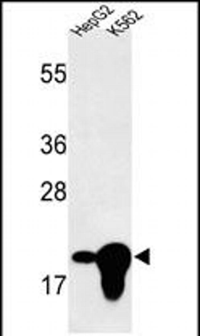 BIN3 Antibody in Western Blot (WB)