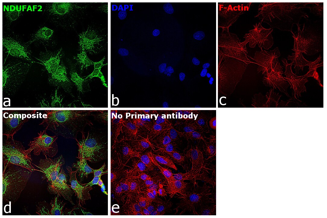 NDUFAF2 Antibody in Immunocytochemistry (ICC/IF)