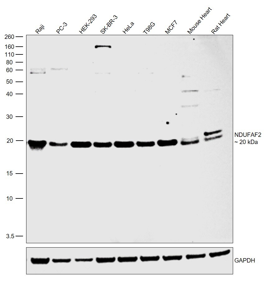 NDUFAF2 Antibody in Western Blot (WB)