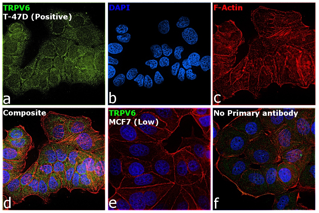 TRPV6 Antibody in Immunocytochemistry (ICC/IF)