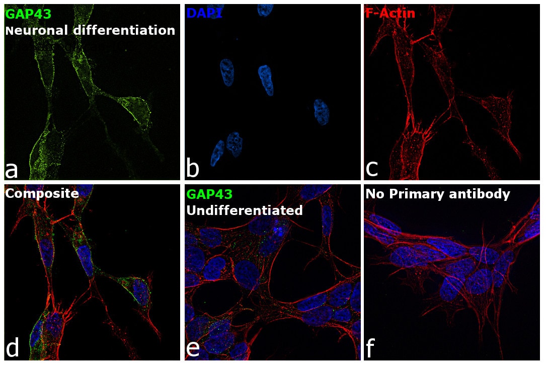 antibody reactivity and specificity