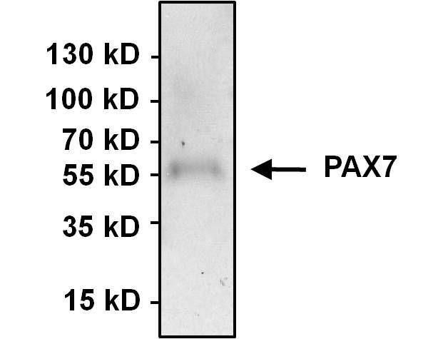 PAX7 Antibody in Immunoprecipitation (IP)