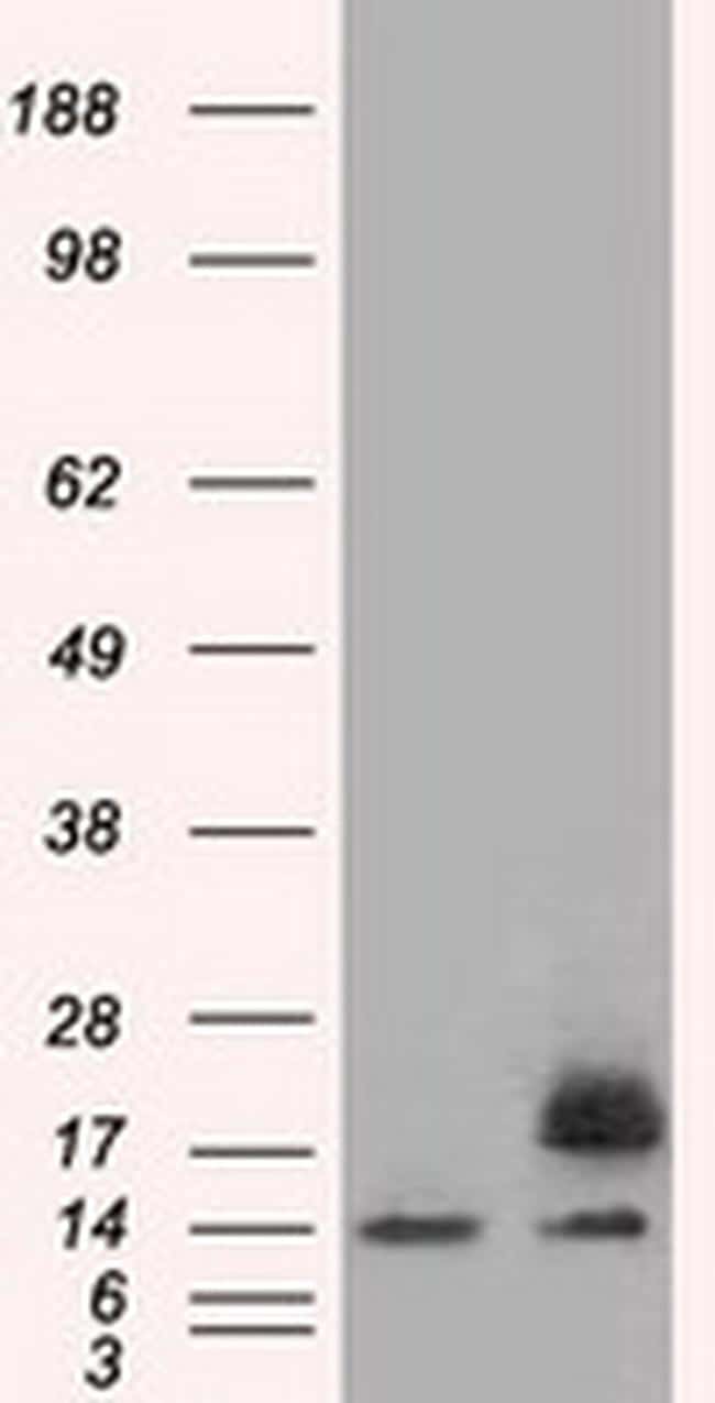 PFN1 Antibody in Western Blot (WB)